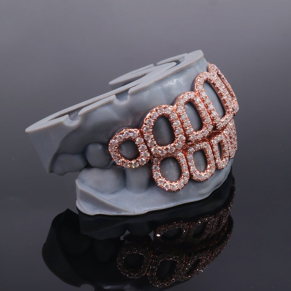 Rose Gold Open Face Custom Diamond Grillz、mySite、hinf8tx79