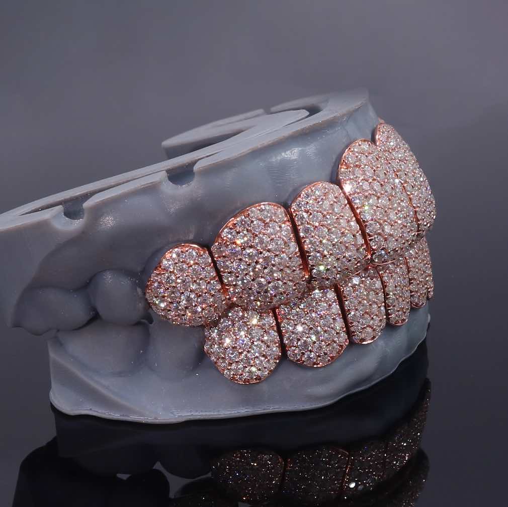 Rose Gold Perm Cut Custom Diamond Grillz 14K Gold、mySite、hinf8tx79