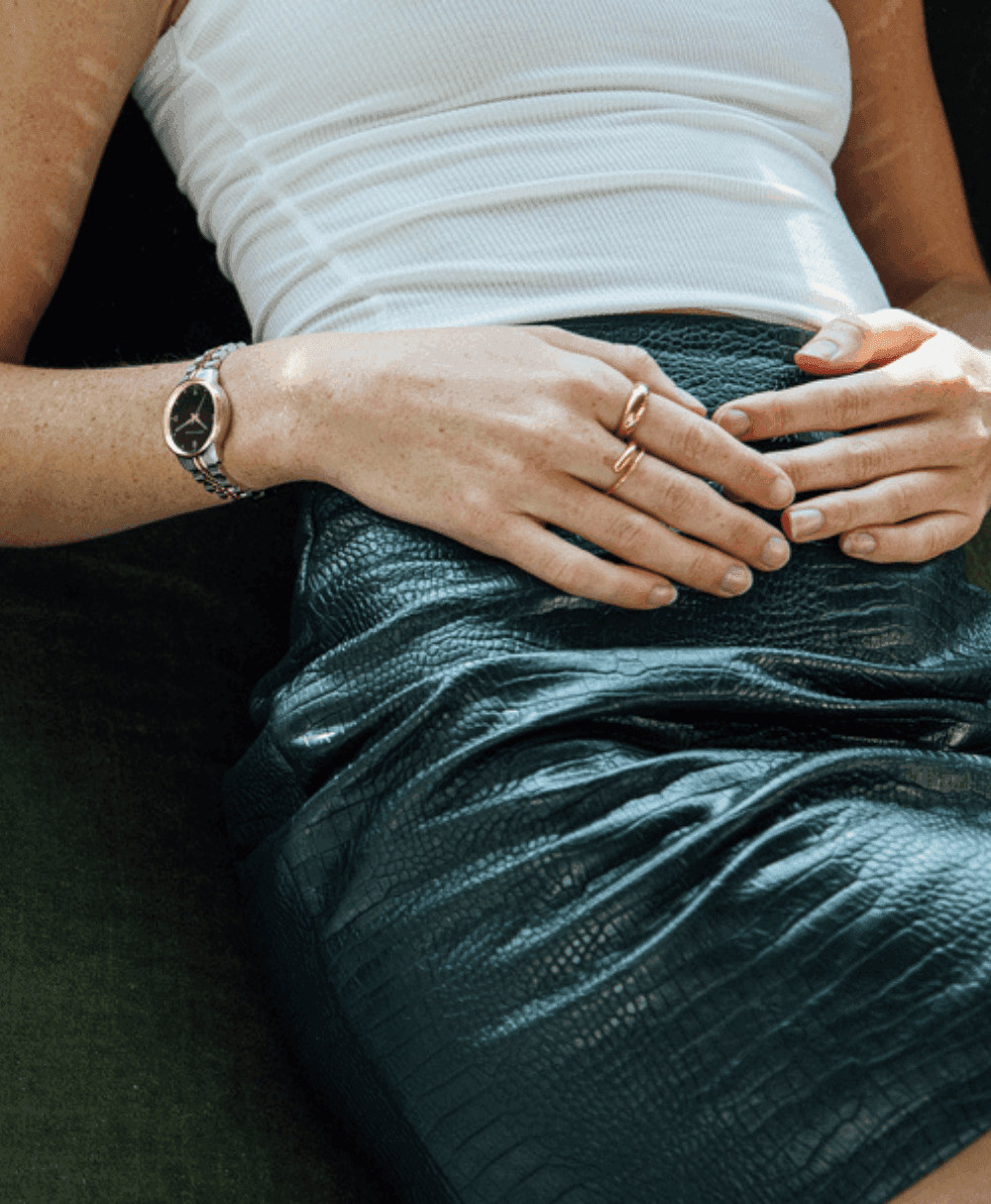  Vivid Link 30mm Rose Gold Black