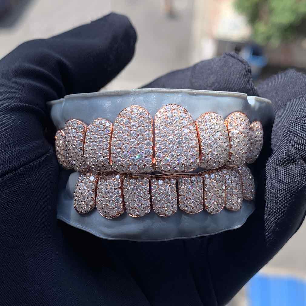 Rose Gold Perm Cut Custom Diamond Grillz 14K Gold、mySite、hinf8tx79