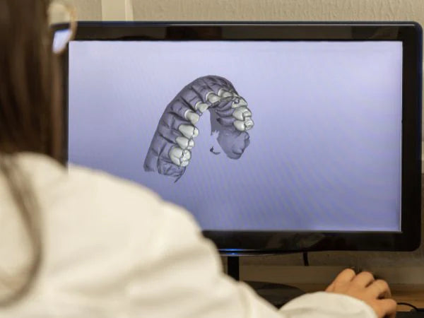 Dental Impression Storage for 2 Year、mySite、gigharbornorthrealestate