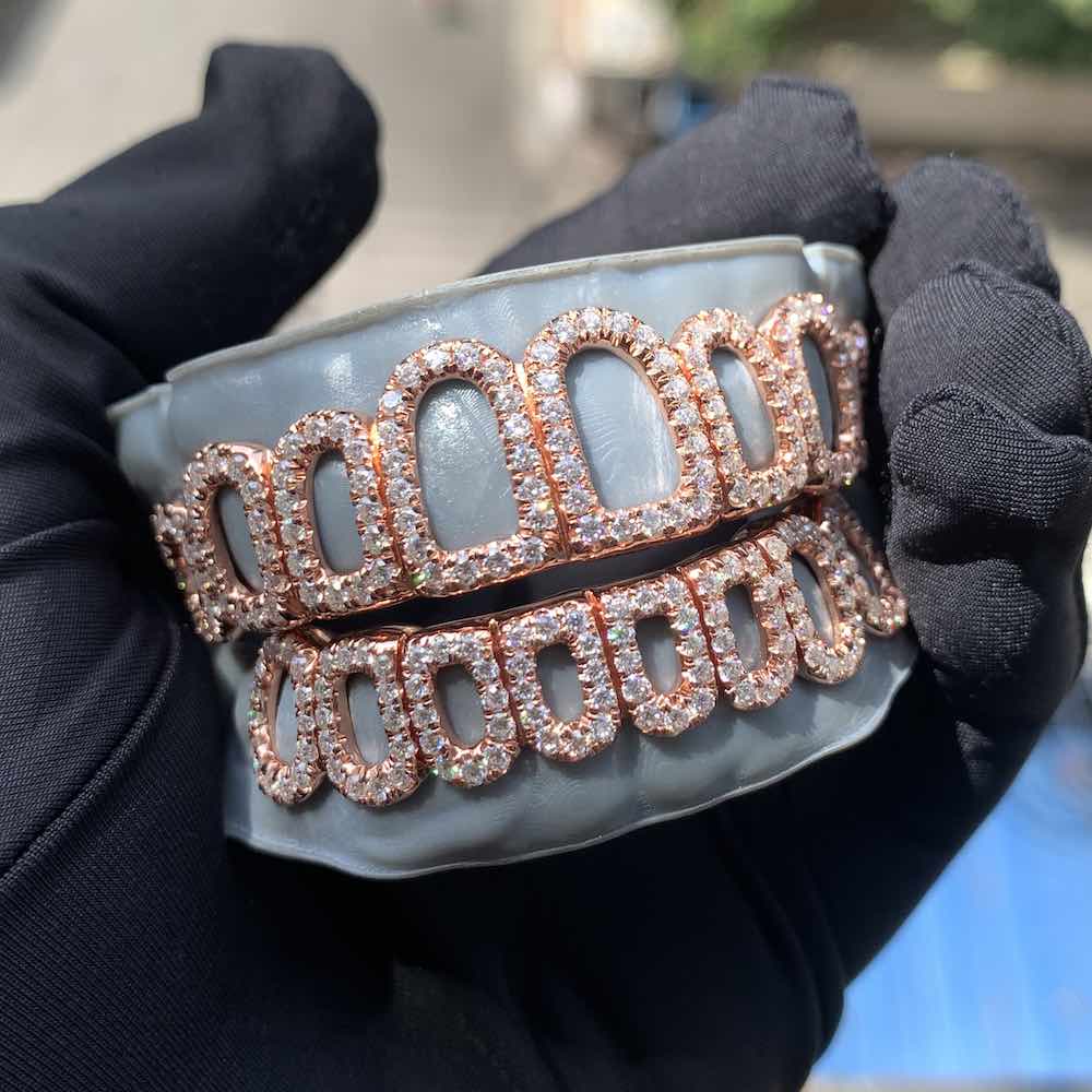 Rose Gold Open Face Custom Diamond Grillz、mySite、hinf8tx79
