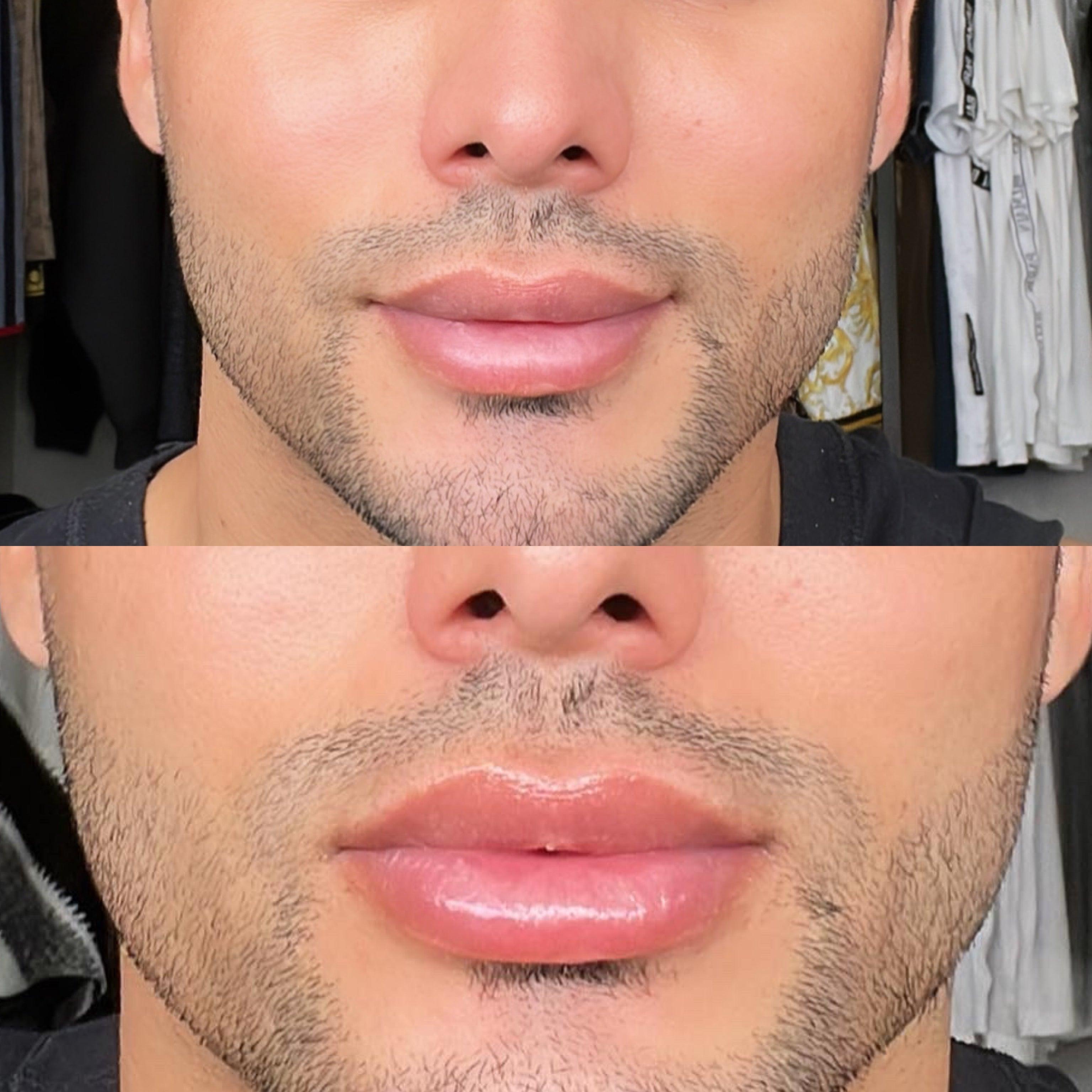 GLOSS com cido Hialurnico e Vit E - aumenta e nutre os l谩bios、mySite、camillekostekn