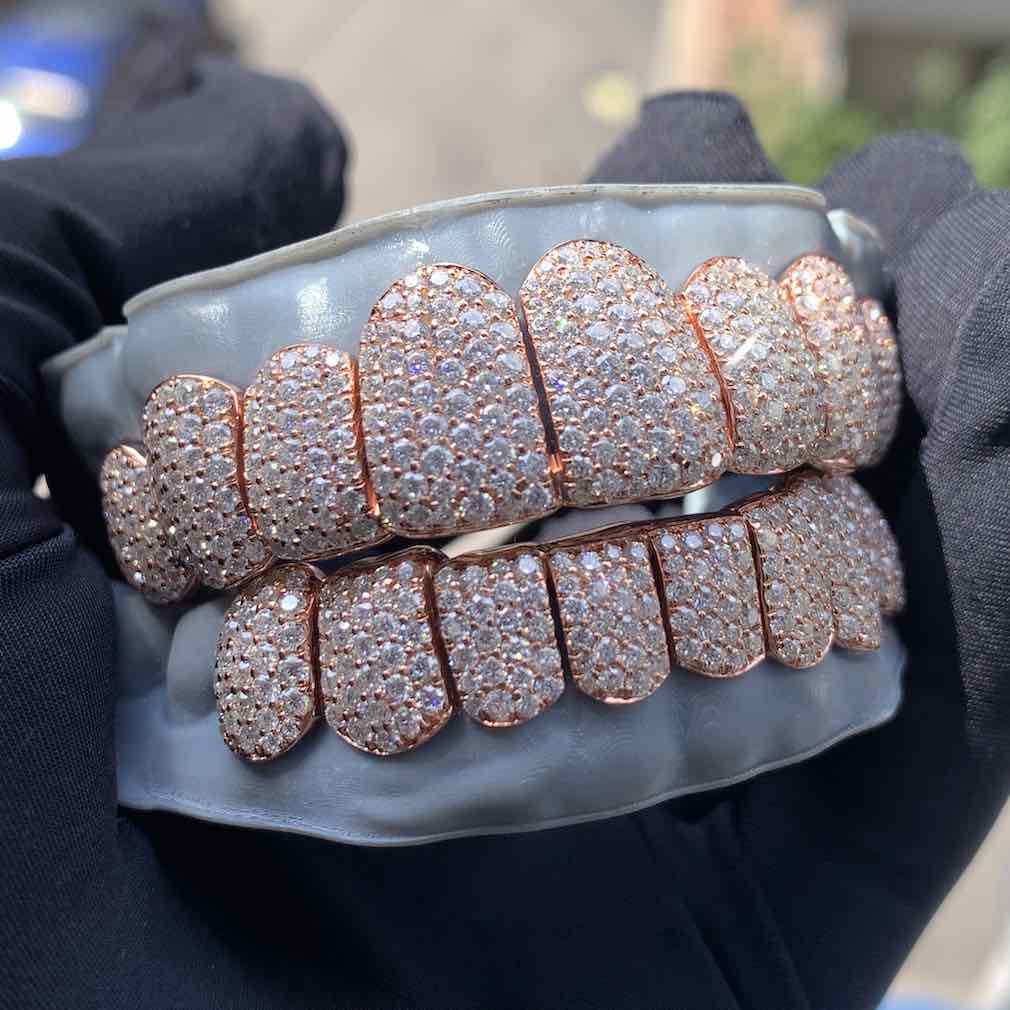 Rose Gold Perm Cut Custom Diamond Grillz 14K Gold、mySite、hinf8tx79