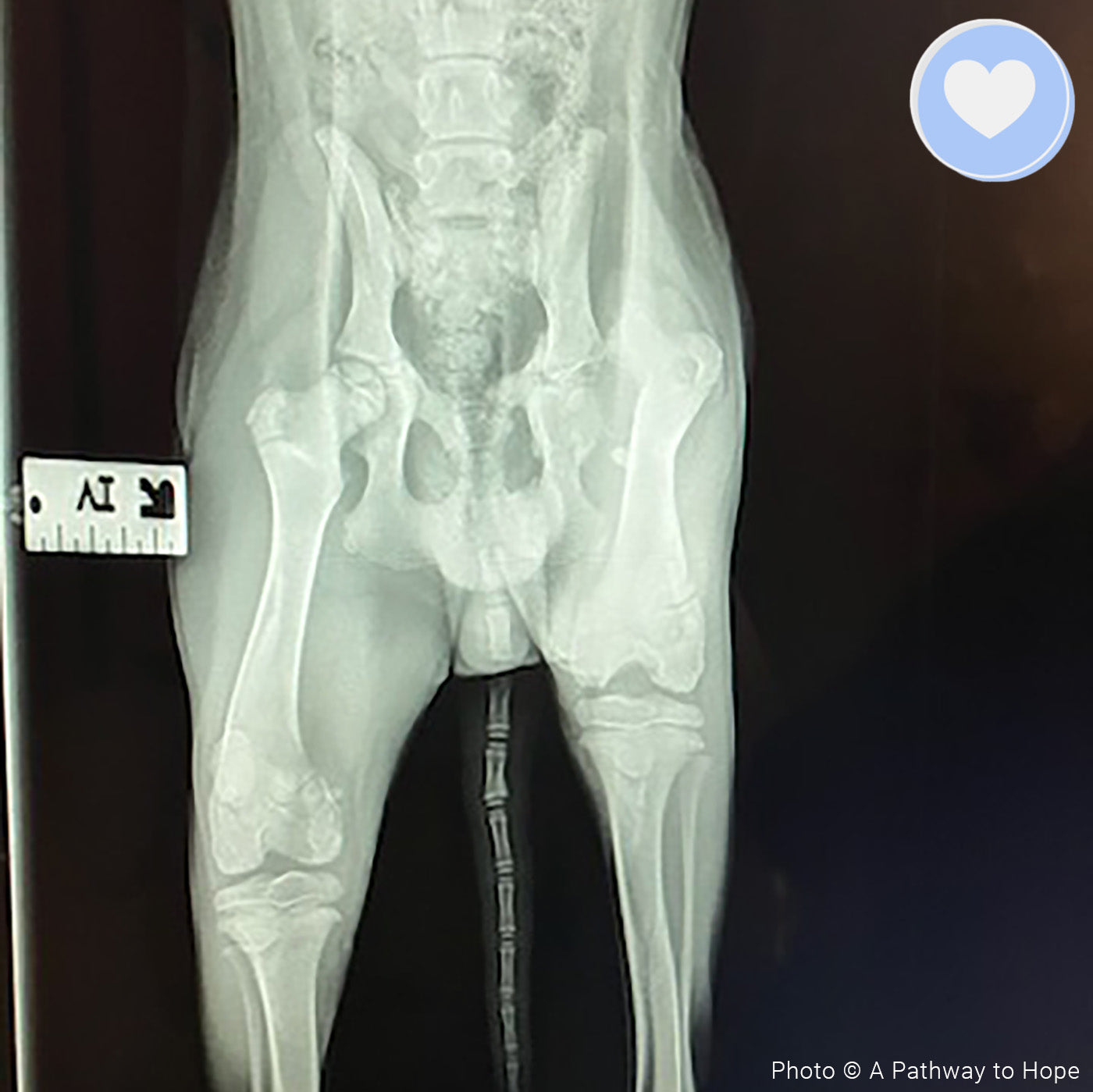 Funded - Help Baylie Recover From a Hit and Run、mySite、camillekostekn