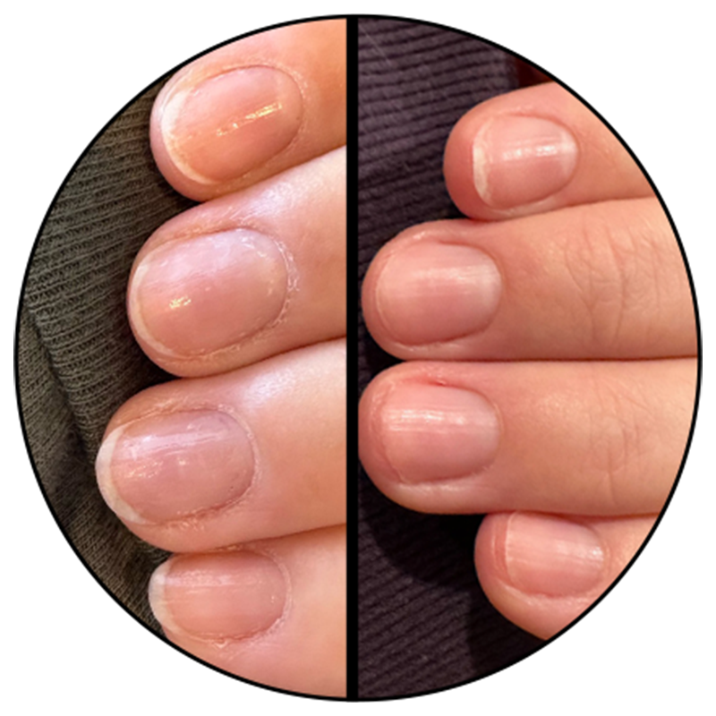 Cuticle Oil、mySite、solidvoid