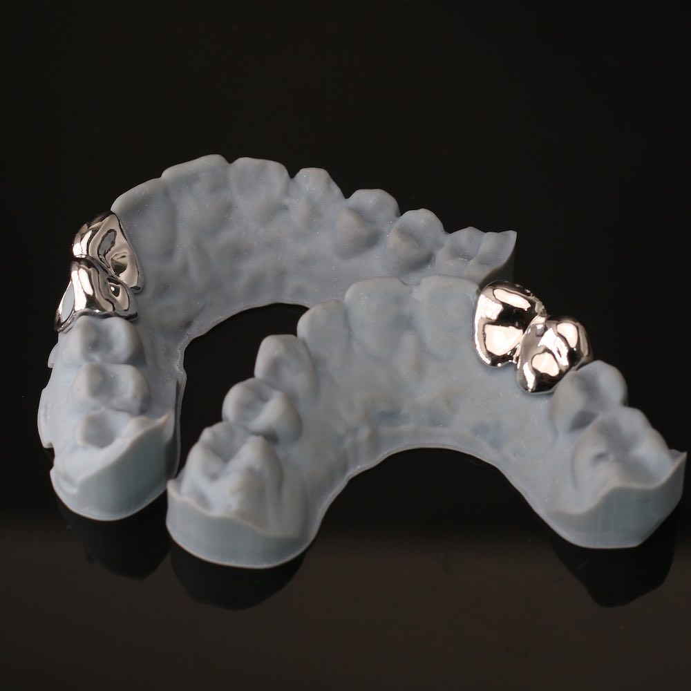 Custom 4 Tooth Grillz、mySite、hinf8tx79