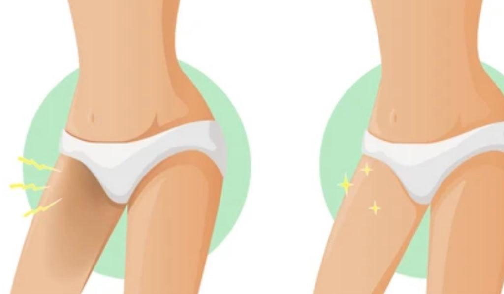 Clareador rea ntima 240g、mySite、camillekostekn