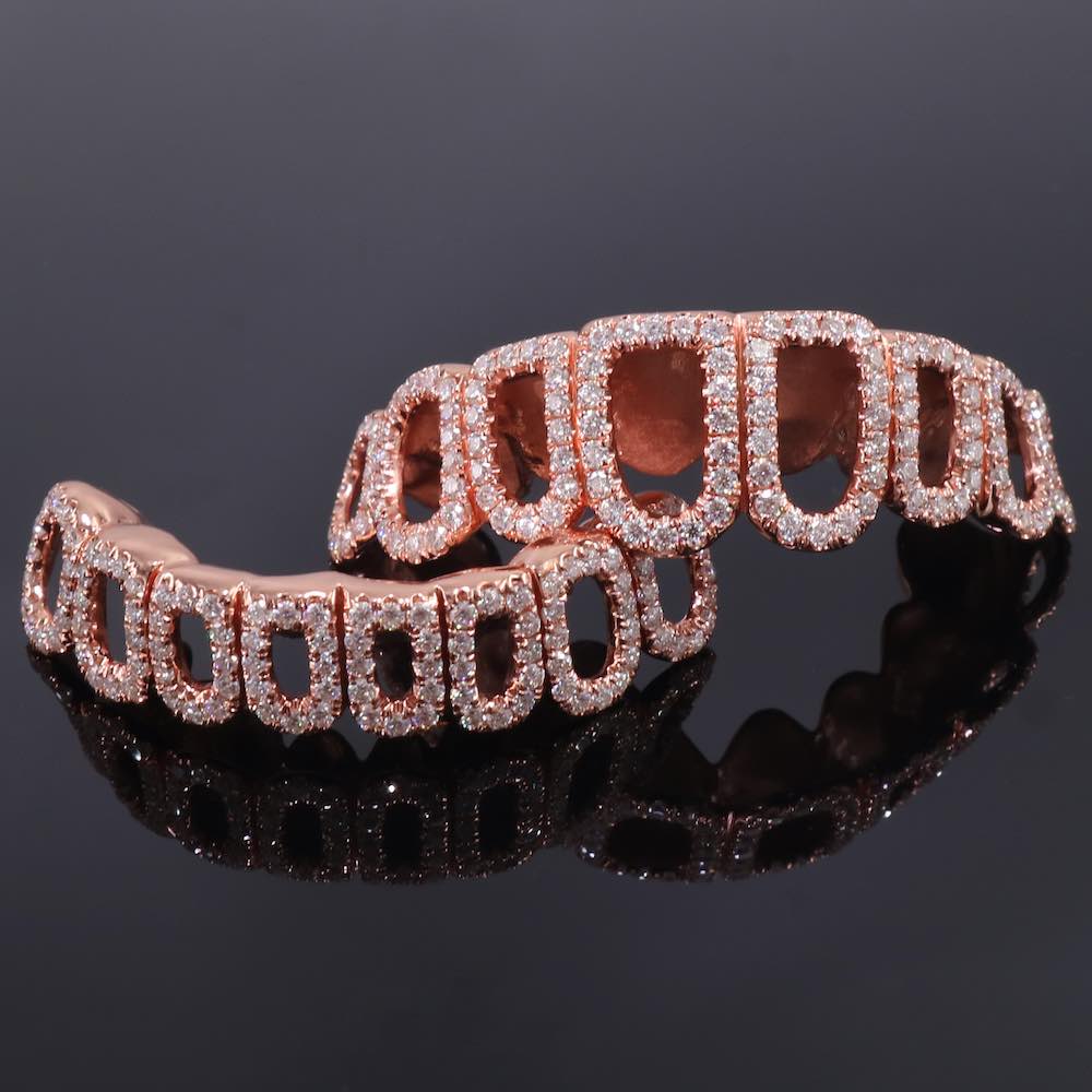 Rose Gold Open Face Custom Diamond Grillz、mySite、hinf8tx79
