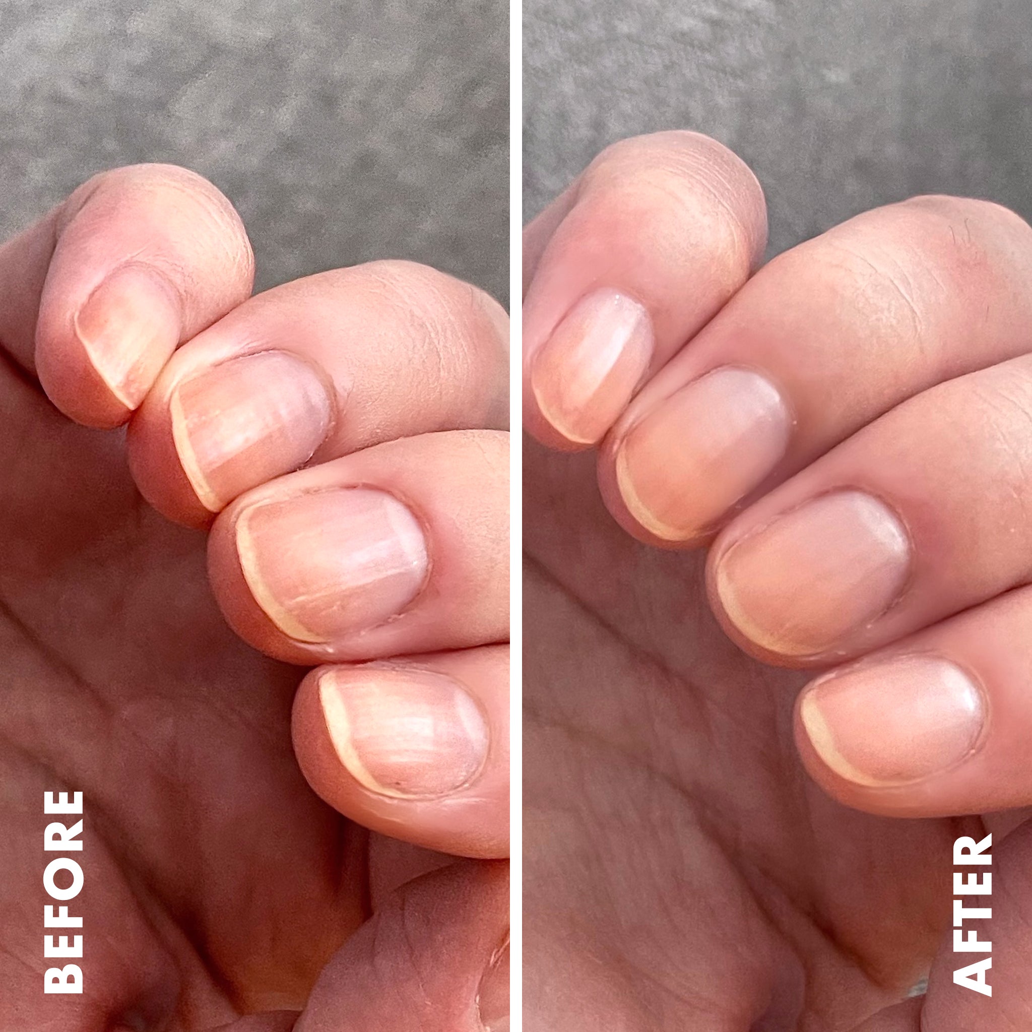 Ridge Filler、mySite、solidvoid