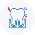 Light wear on teeth