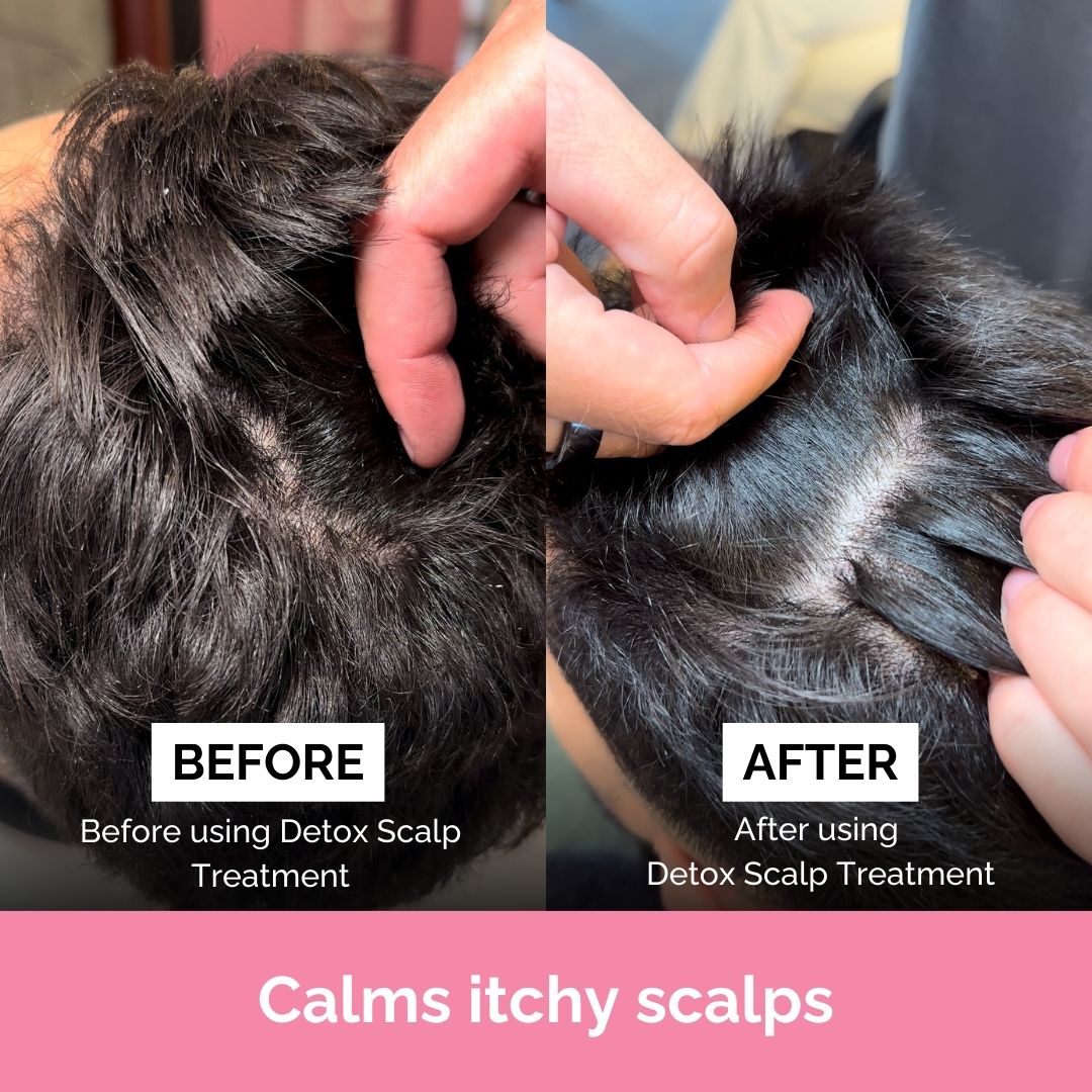  FUL Detox Scalp Treatment、mySite、elrpsem3k