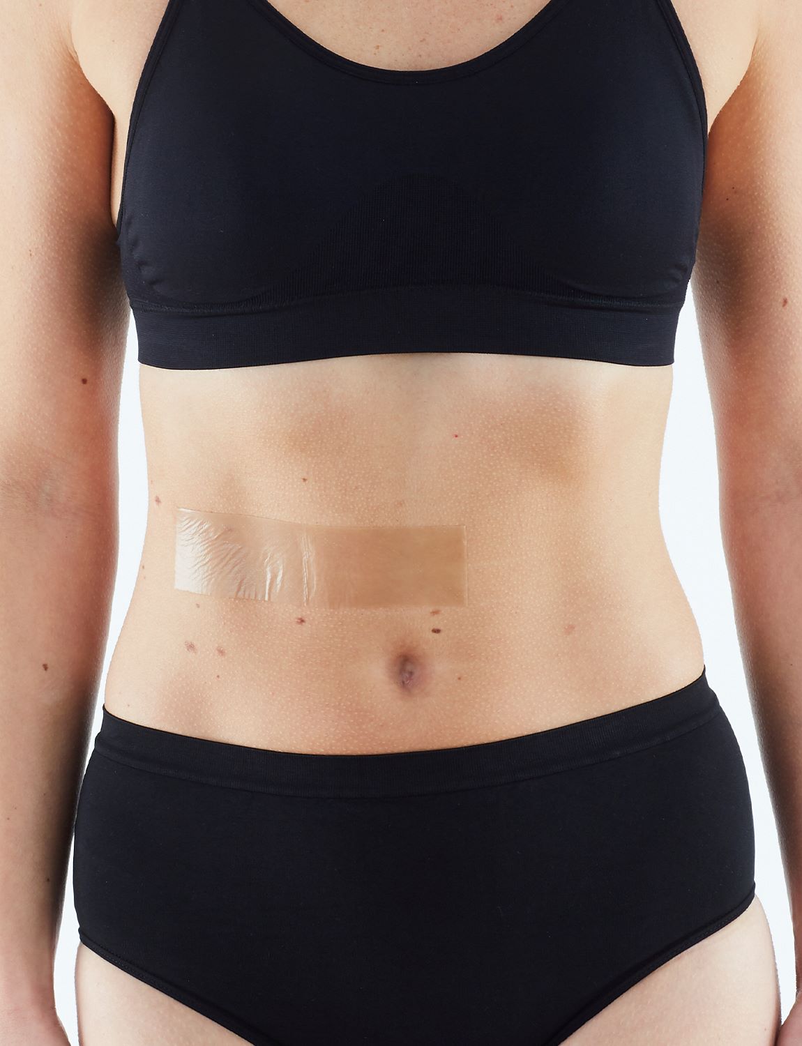  Silicone Scar & Wound Recovery Strips、mySite、preschool7hills