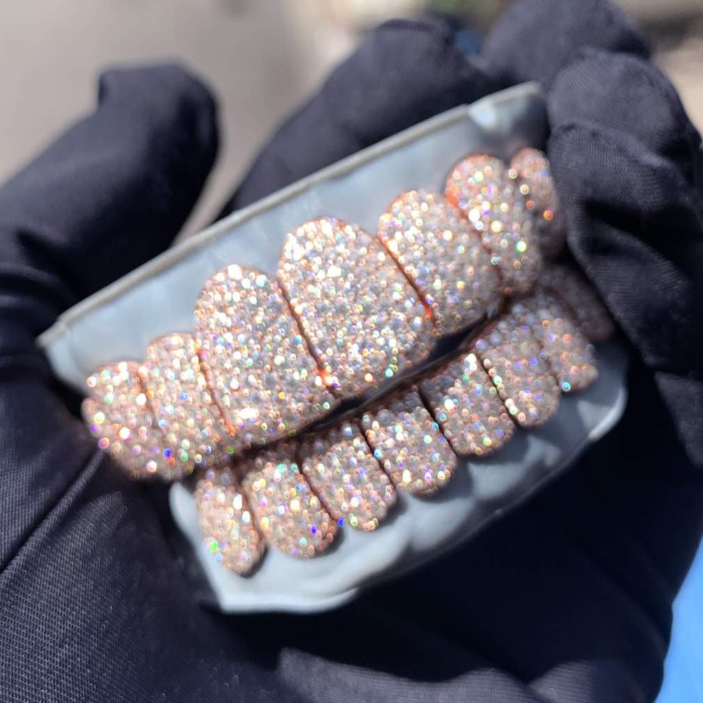 Rose Gold Perm Cut Custom Diamond Grillz 14K Gold、mySite、hinf8tx79