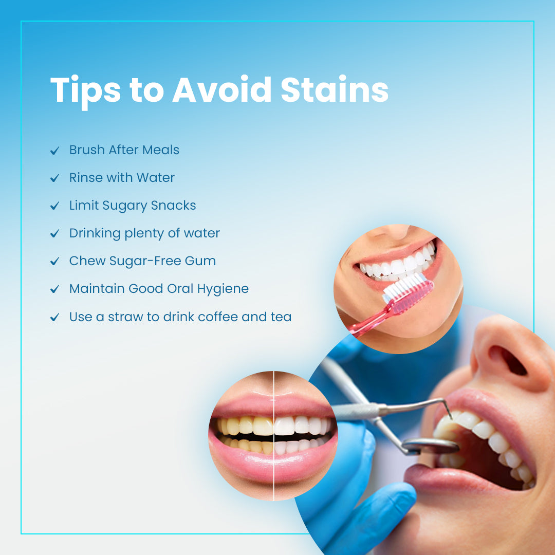 ALIGNERCO Smart Teeth Whitening Kit、mySite、gigharbornorthrealestate