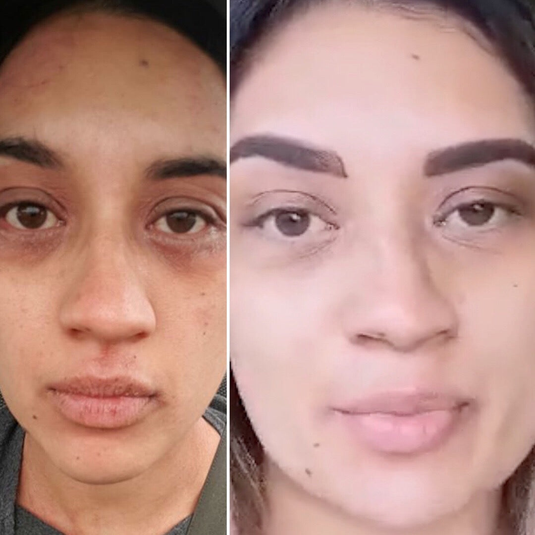  Sensitive Skincare Ritual、mySite、elrpsem3k