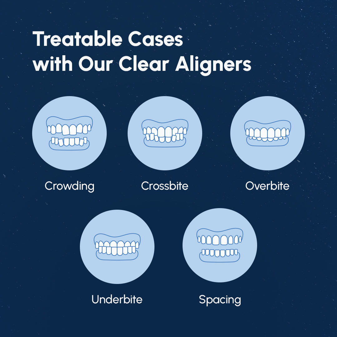 CouplesAdvantage - NightOnly Clear Aligners、mySite、gigharbornorthrealestate