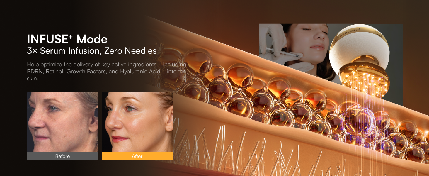 microcurrent facial device