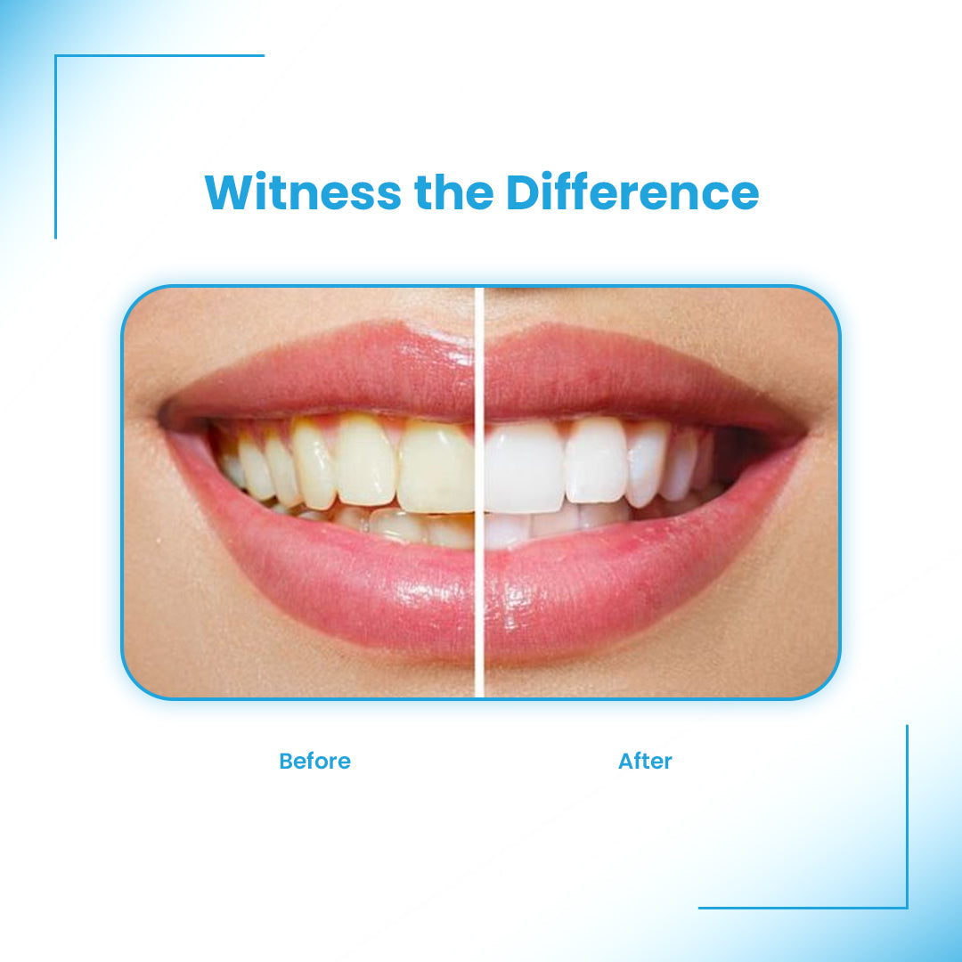 Aligner Cleaner + Whitener、mySite、gigharbornorthrealestate