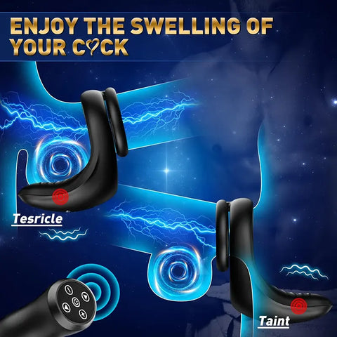 Remote-Control Perineum Vibrating Cock Ring