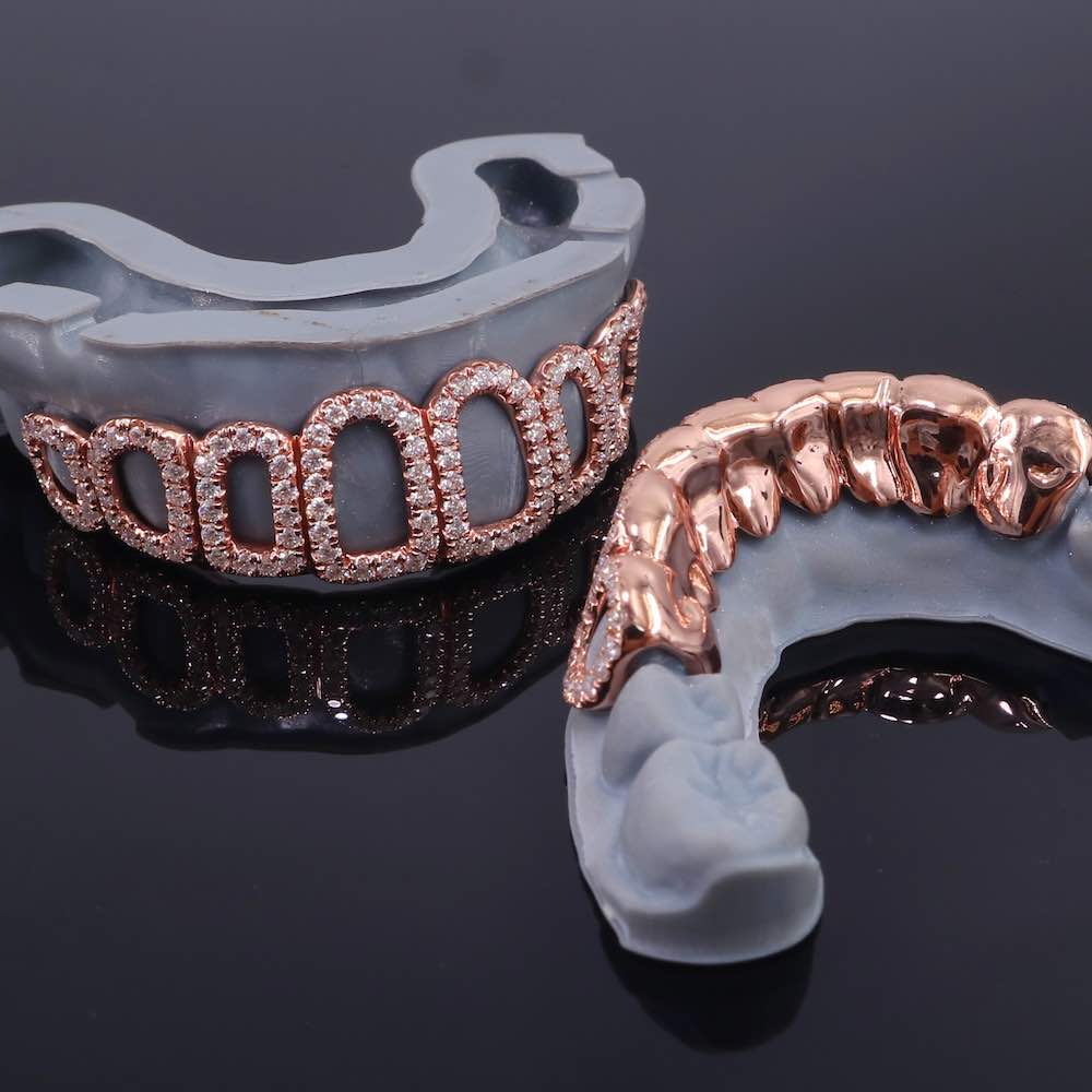 Rose Gold Open Face Custom Diamond Grillz、mySite、hinf8tx79