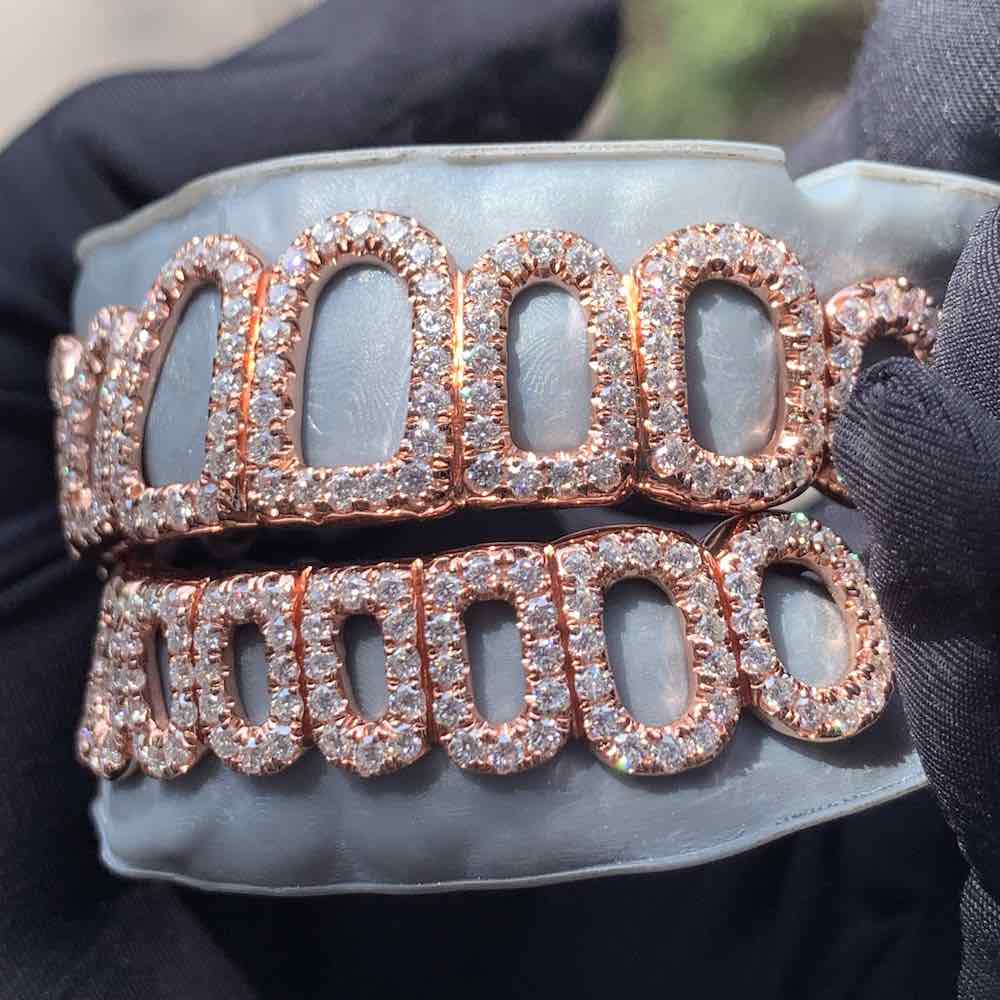 Rose Gold Open Face Custom Diamond Grillz、mySite、hinf8tx79