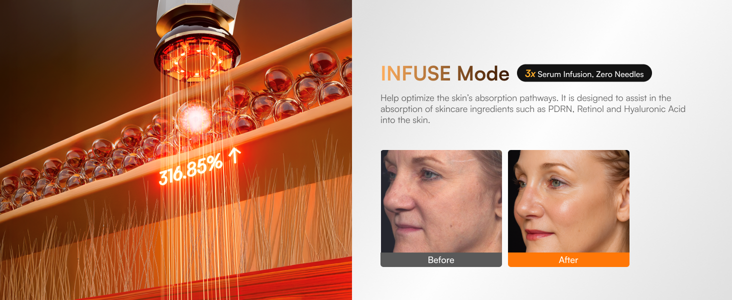 INFUSE Mode