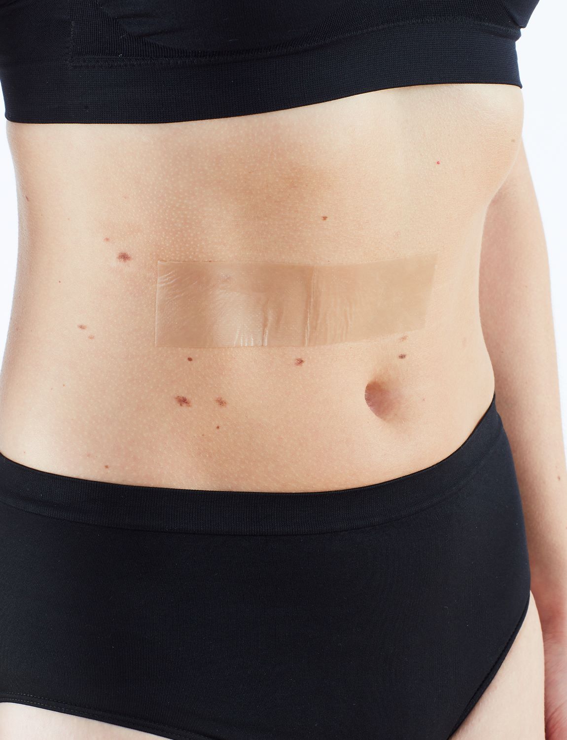  Silicone Scar & Wound Recovery Strips、mySite、preschool7hills