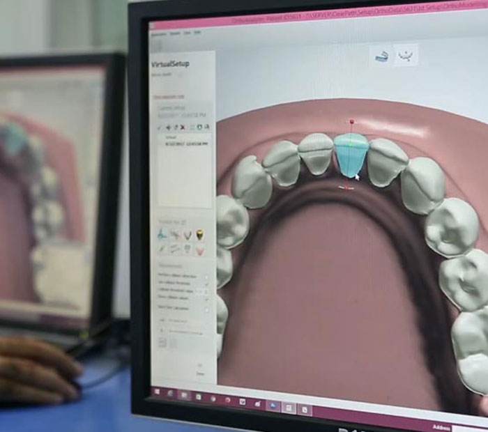 SmileFlex Easy、mySite、gigharbornorthrealestate