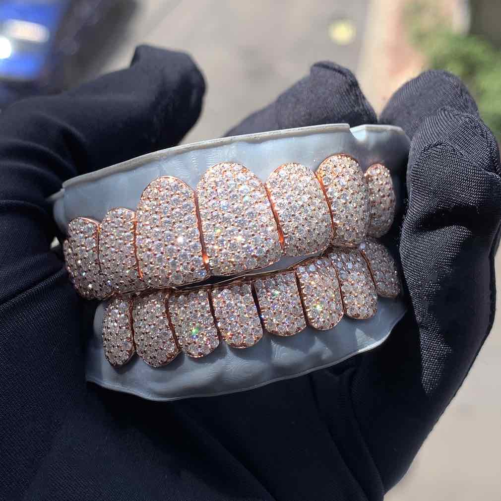 Rose Gold Perm Cut Custom Diamond Grillz 14K Gold、mySite、hinf8tx79