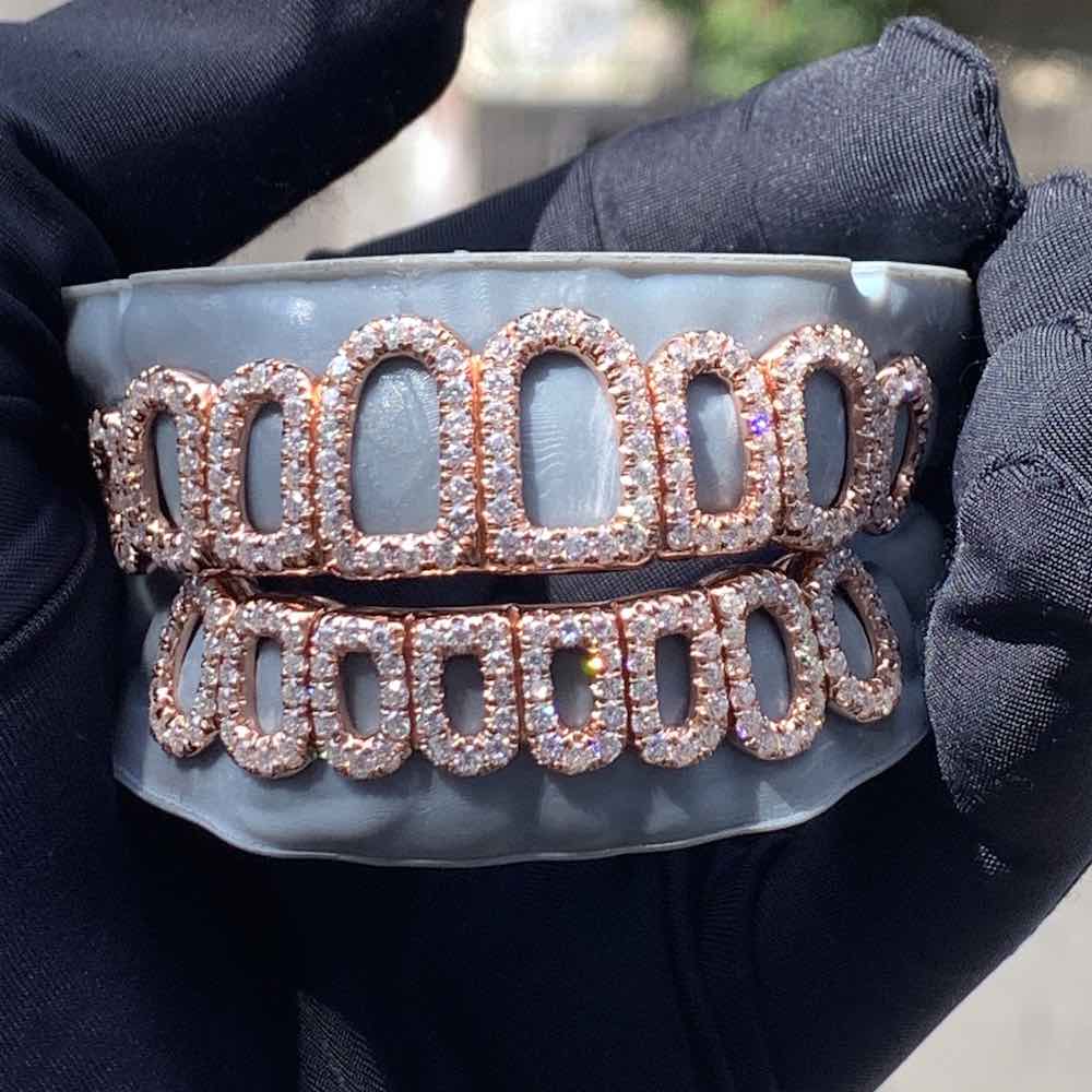 Rose Gold Open Face Custom Diamond Grillz、mySite、hinf8tx79