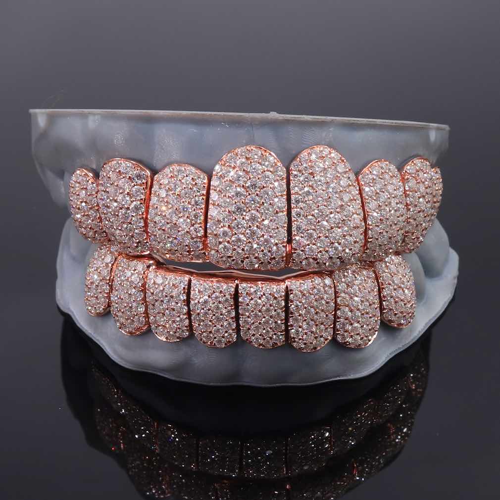 Rose Gold Perm Cut Custom Diamond Grillz 14K Gold、mySite、hinf8tx79