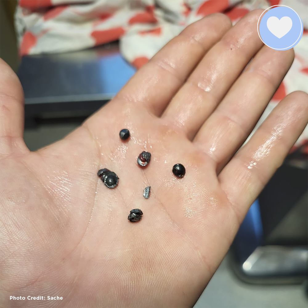 Funded: Alice Was Shot: Help Save Her Life、mySite、camillekostekn