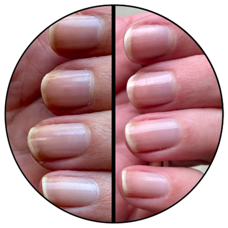 Nail Hardener、mySite、solidvoid