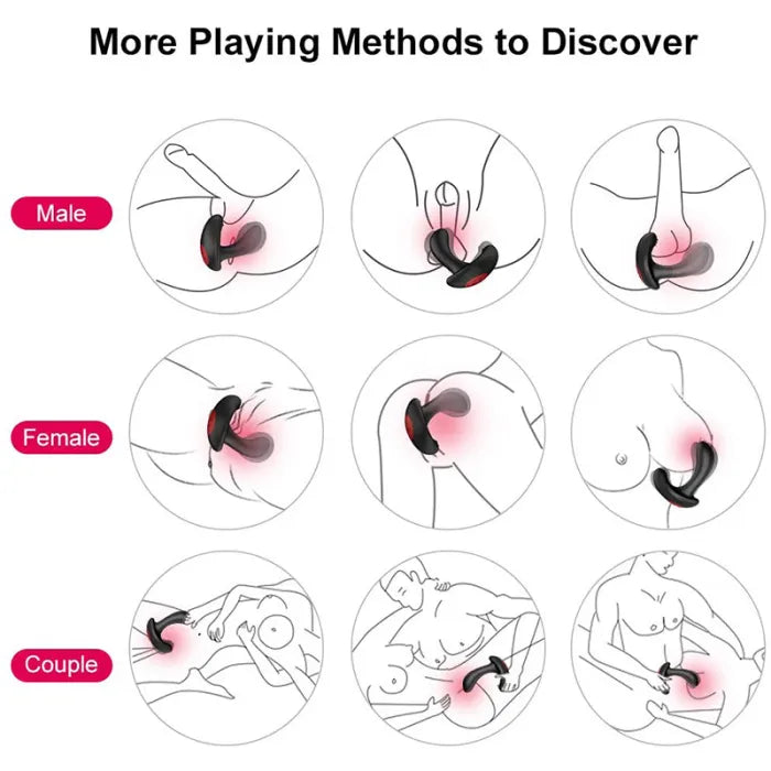 Ass Gasm Expander | Vibrating | Remote Control | 10 Modes | USB、mySite、bottomscart