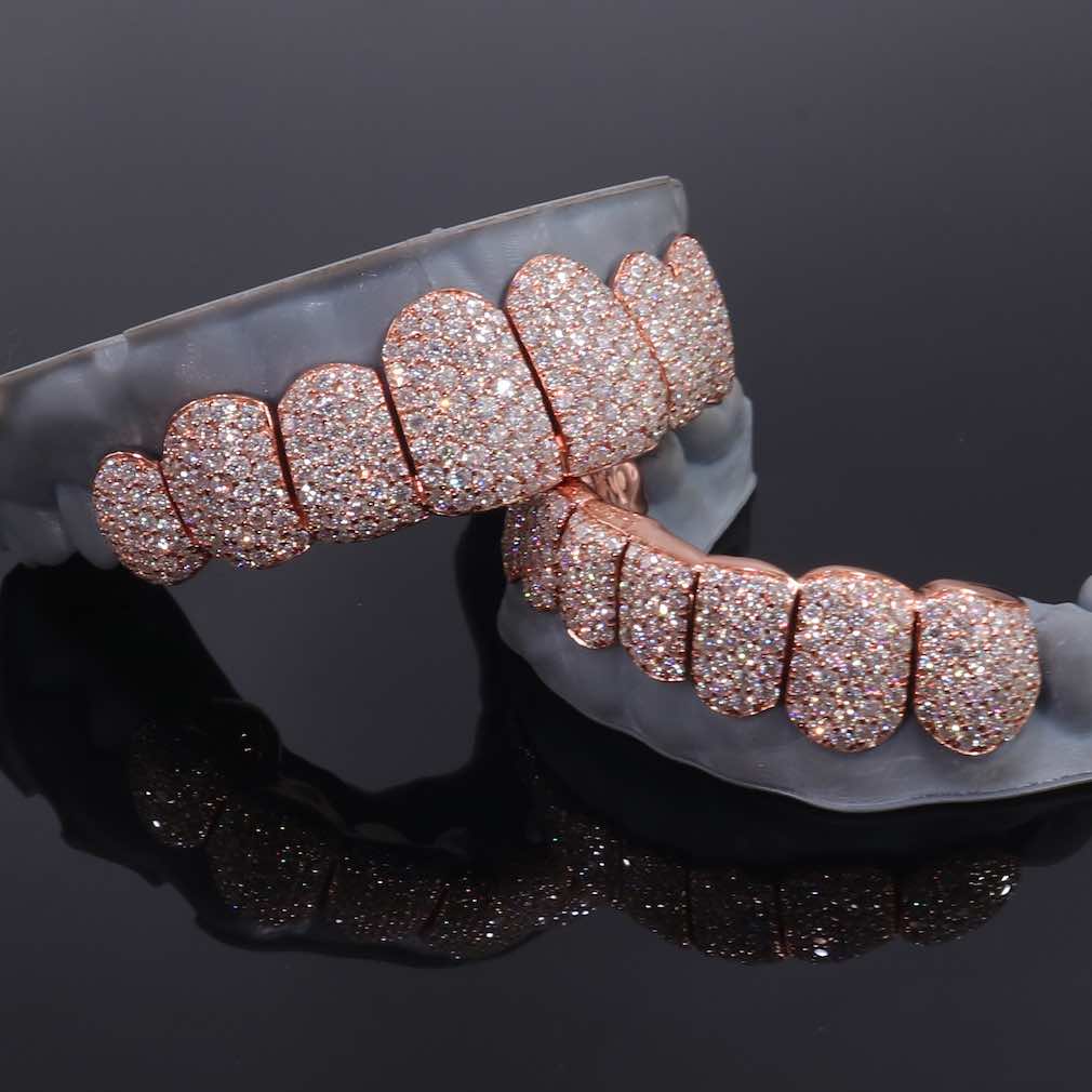 Rose Gold Perm Cut Custom Diamond Grillz 14K Gold、mySite、hinf8tx79