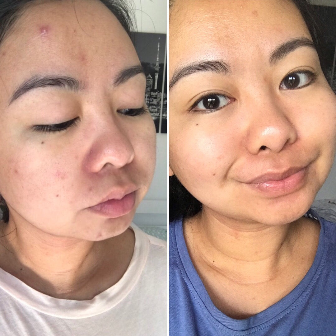  Sensitive Skincare Ritual、mySite、elrpsem3k